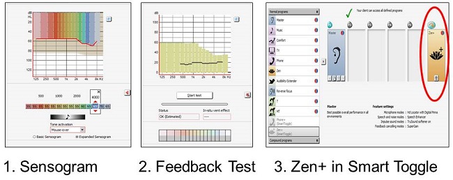 Widex Zen Clinical Studies