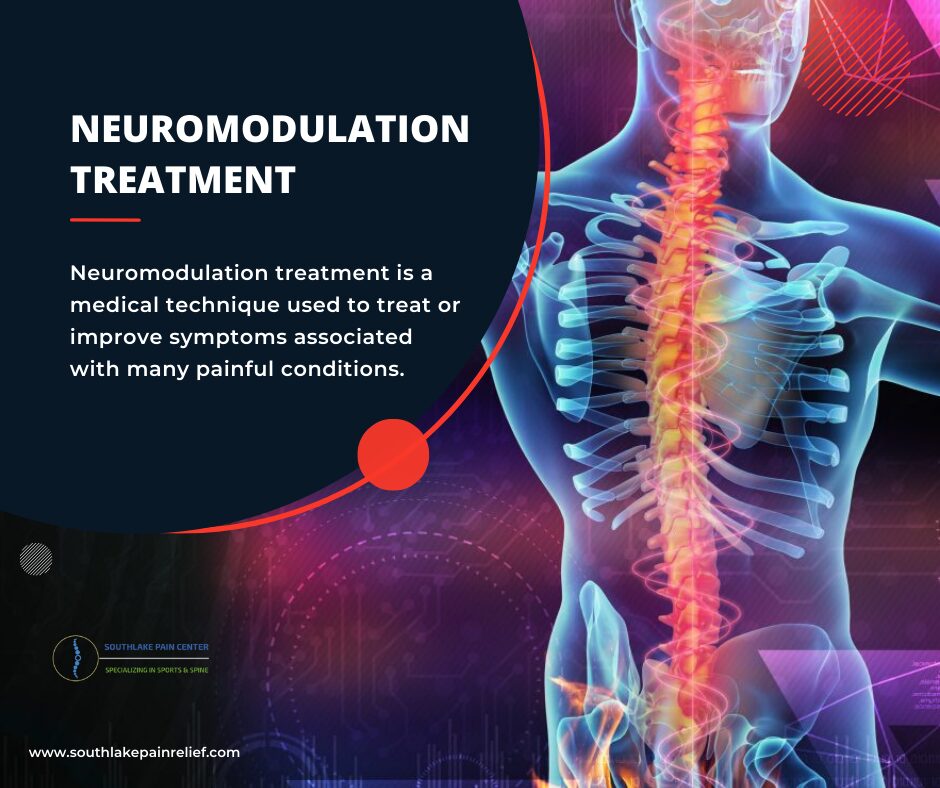 Neuromodulation Treatment