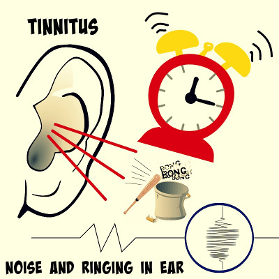 Tinnitus and Constant Ringing