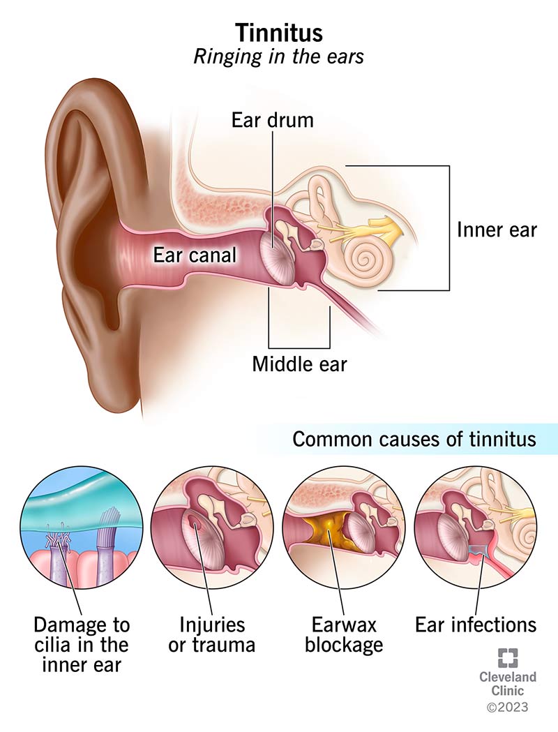 tinnitus compounds treatment difficulties