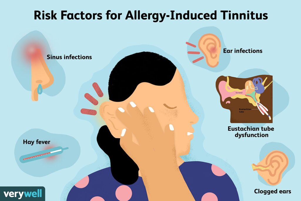 Kali Mur - For Tinnitus with Middle Ear Congestion