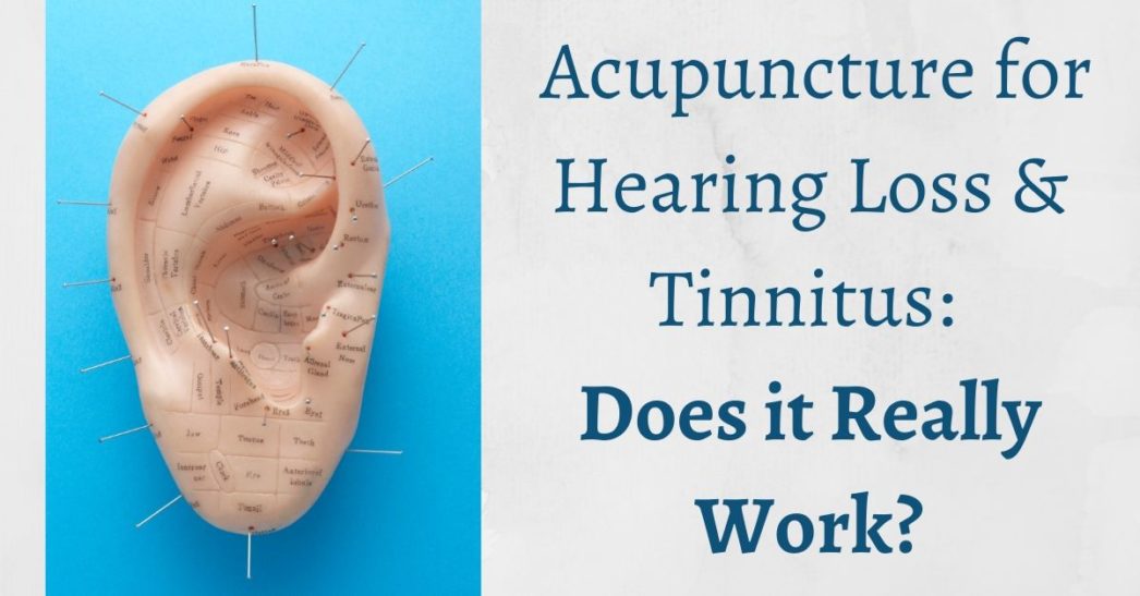 Benefits of Acupuncture for Tinnitus