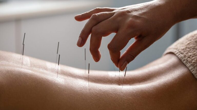 Acupuncture for Tinnitus